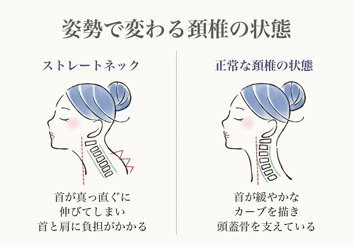 日常生活の“前傾姿勢”が体のゆがみに